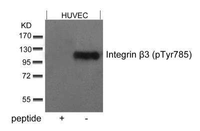 Western Blot: Integrin beta 3/CD61 [p Tyr785] Antibody [NB100-81995]